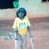 Disabled Girl